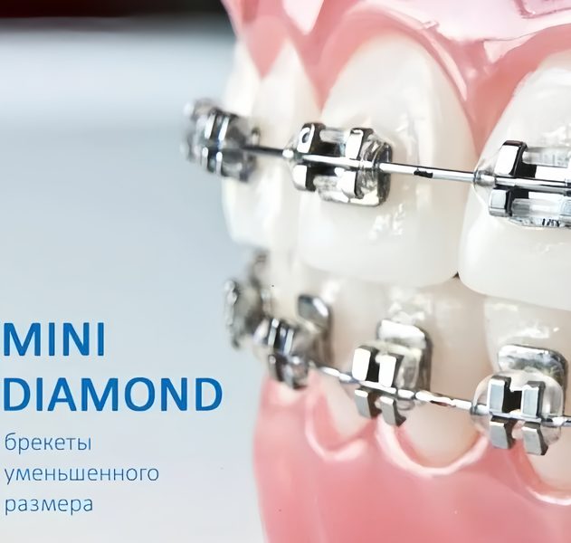 Брекеты Mini Diamond